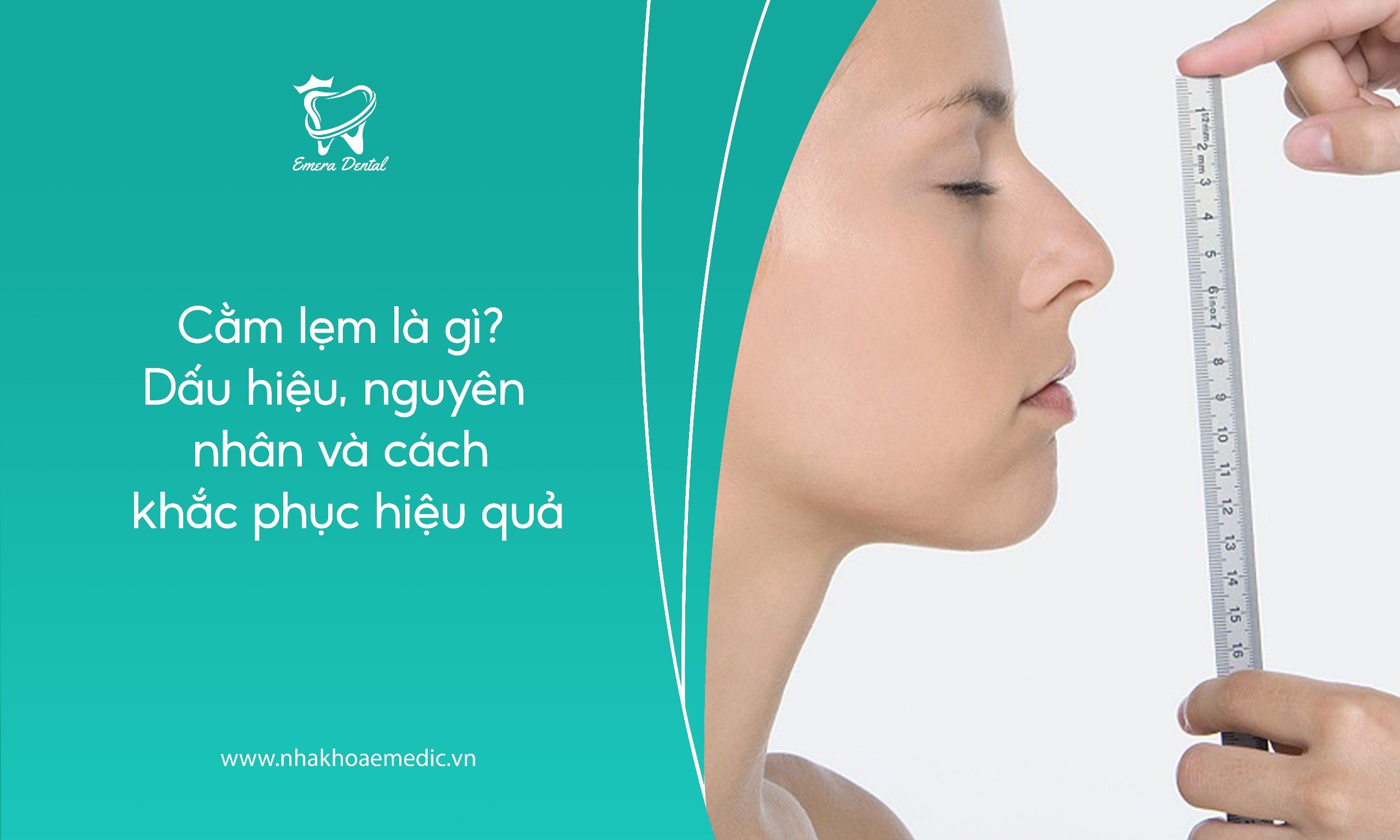 Cằm lẹm là gì? Dấu hiệu, nguyên nhân và cách khắc phục hiệu quả